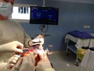 Chirurgická léčba gonartrózy